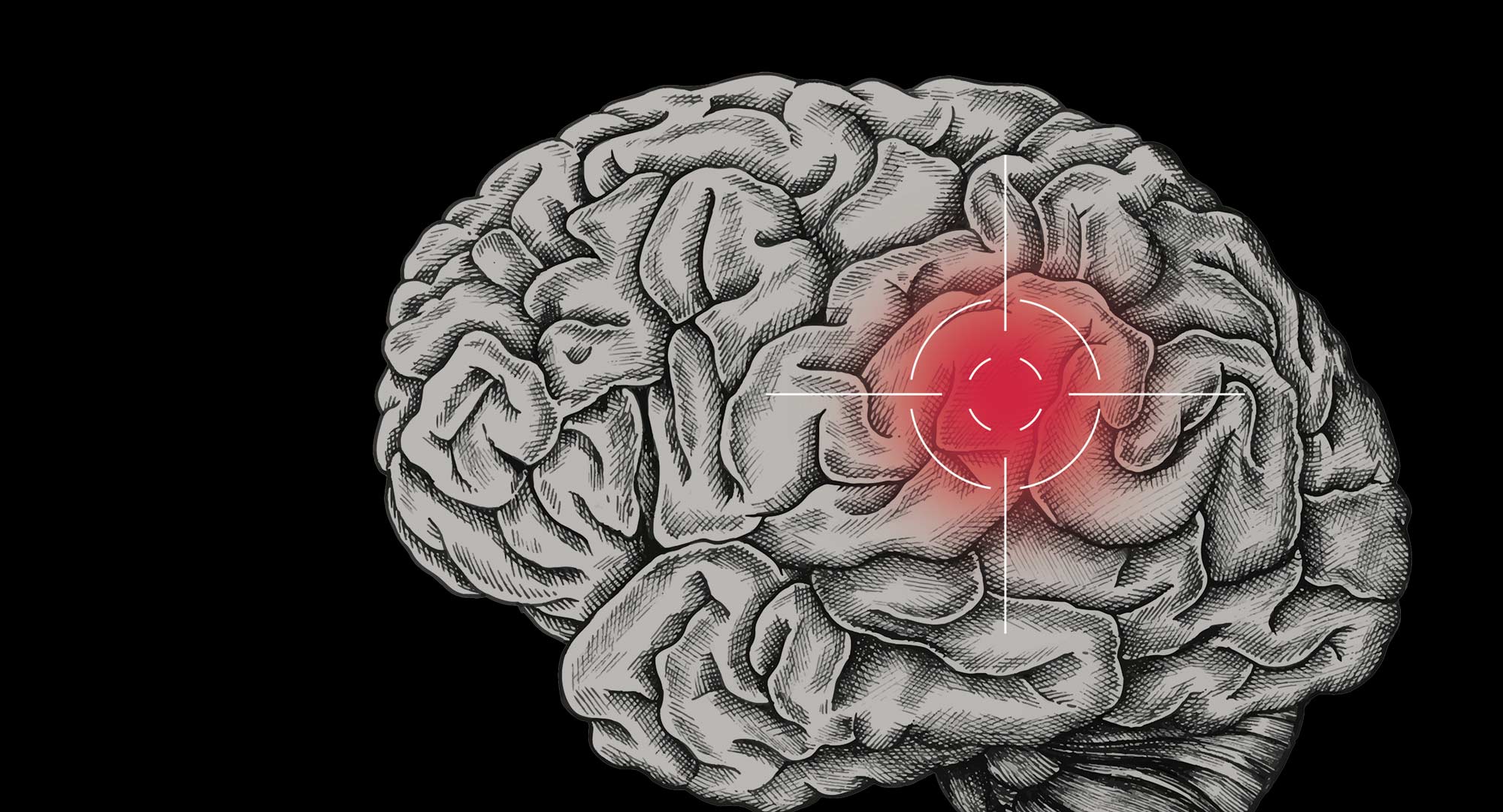 An illlustration of a brain with targeted red spot on it.