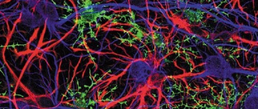 Image of brain neurons and synapses