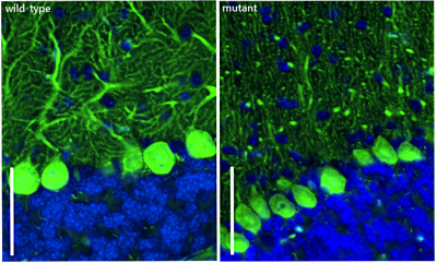 Pictures of the cerebellum in wild-type and mutant mice