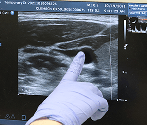 hand looking at ultrasound