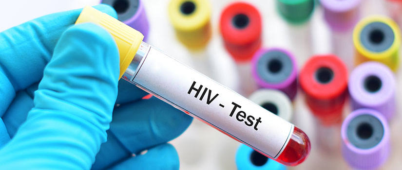 HIV/AIDS self-test