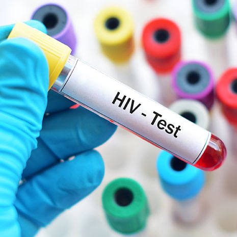 Image of test tube labeled HIV