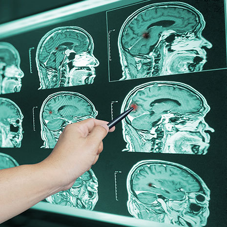 images of the brain