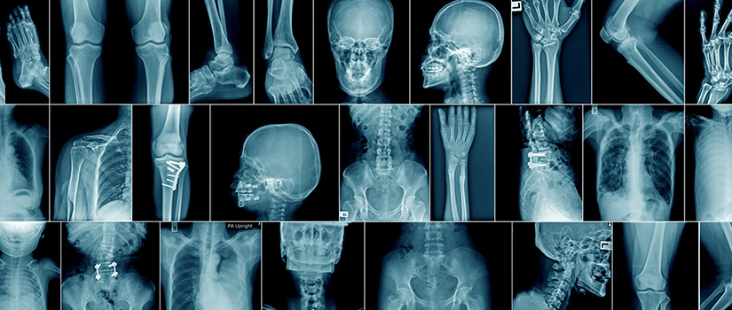X-Ray images