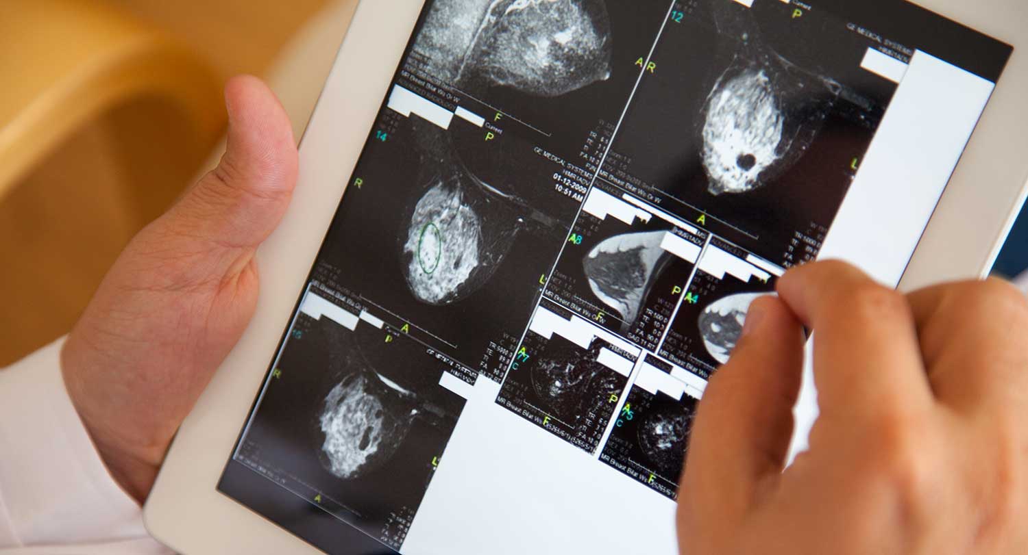 Images from a breast cancer scan are reviewed on a digital tablet held by a health care professional.