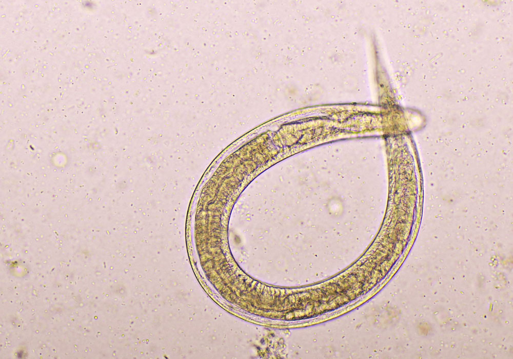 A close-up of a Strongyloides worm under a microscope
