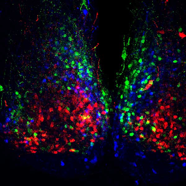 Red, blue, black and green scan of a brain