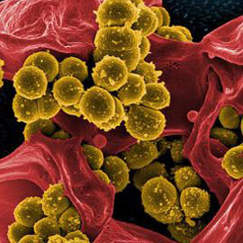 antibiotic-resistant bacteria
