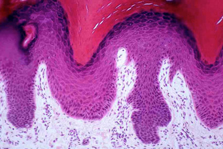 Histology slide of human skin, epidermis and dermis